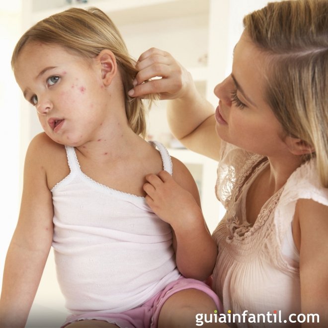 Alergia primaveral en niños: cómo reconocerla